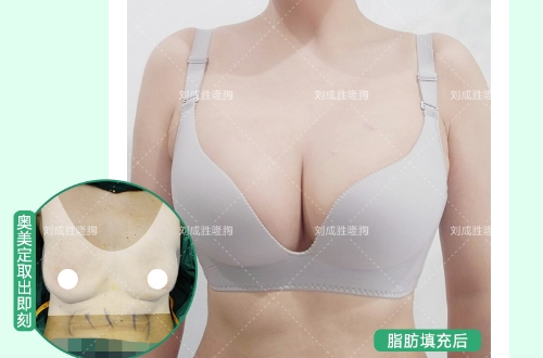 丰体针丰胸手术中你忽略的那些健康危害